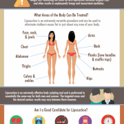 What Areas of the Body can be Treated with Liposuction? Scottsdale Lipo Questions.