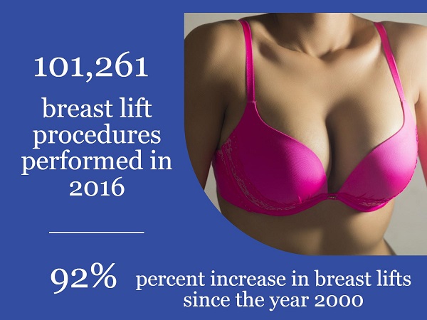 Breast lift statistics 