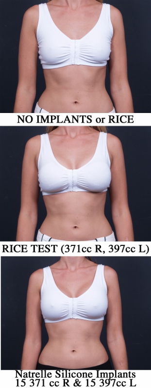 Rice Test